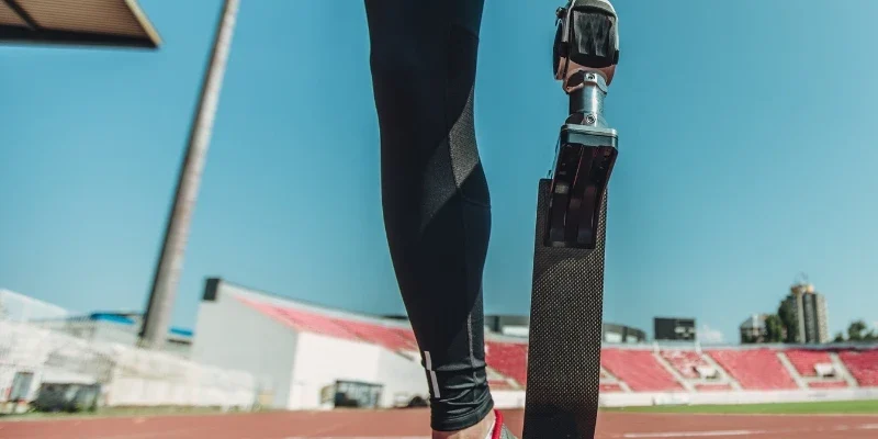 протезные части